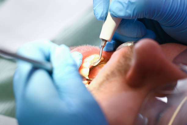 Best Emergency Root Canal Treatment in Highland Park, NJ